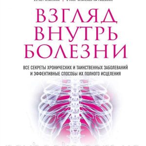 Взгляд внутрь болезни - Энтони Уильям